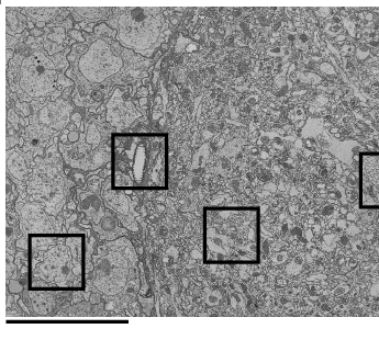 A grey electron micrograph of fly brain tissue: a dense field of cell
                  membranes, mitochondria and neurites in cross-section.
